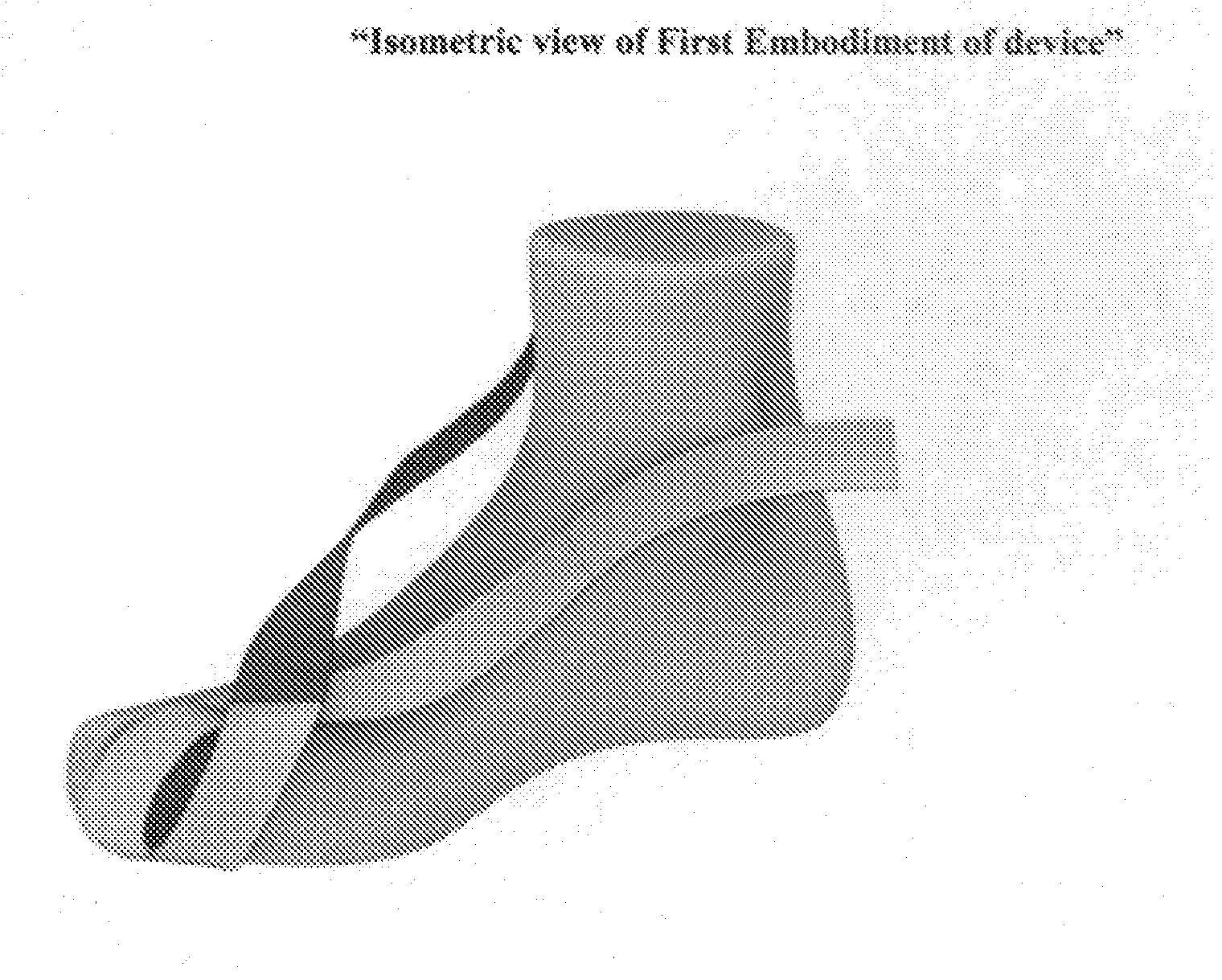 Dynamic Hallux Tension Device For Treatment of Plantar Faciitis