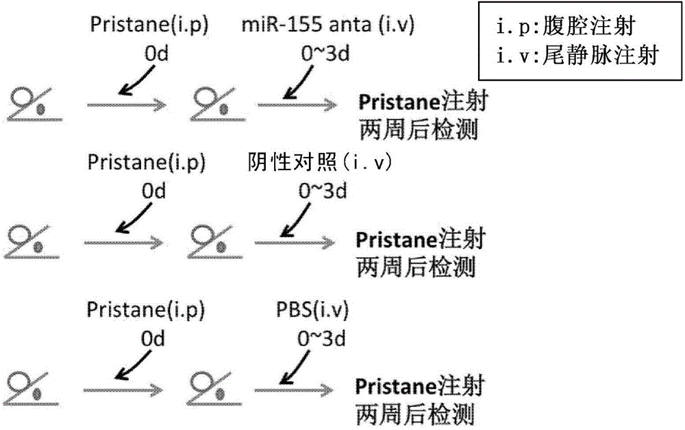 Use of miR-155 in preparation of acute lung injury prevention and treatment drugs