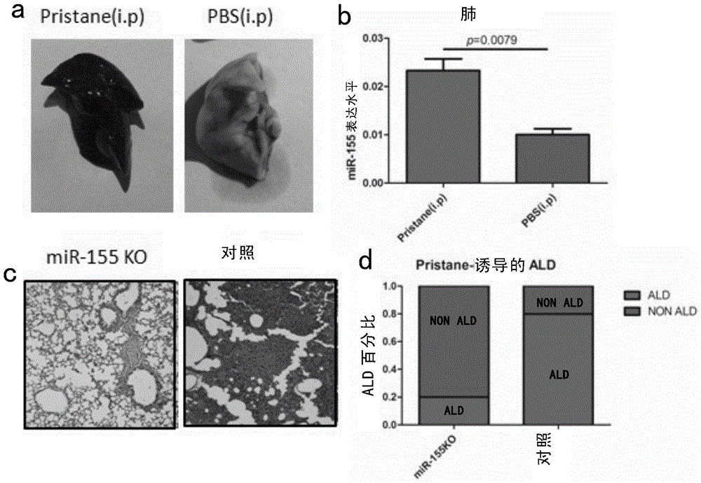 Use of miR-155 in preparation of acute lung injury prevention and treatment drugs