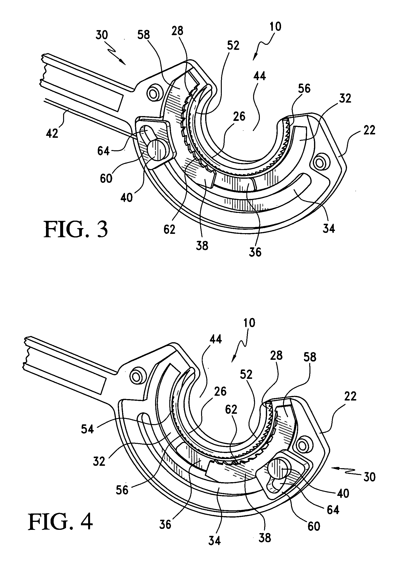 Surgical suturing apparatus with collapsible vacuum chamber
