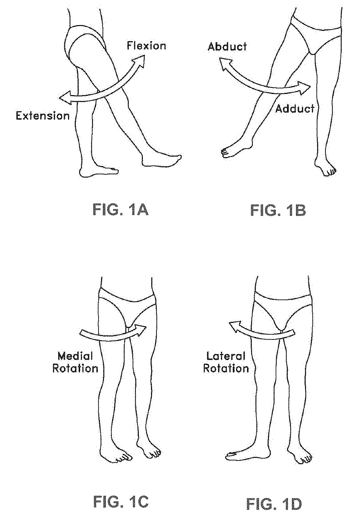 Systems and methods for pre-operative visualization of a joint