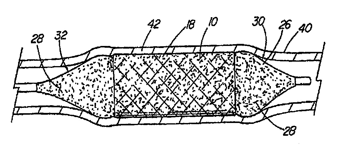 Coated medical device