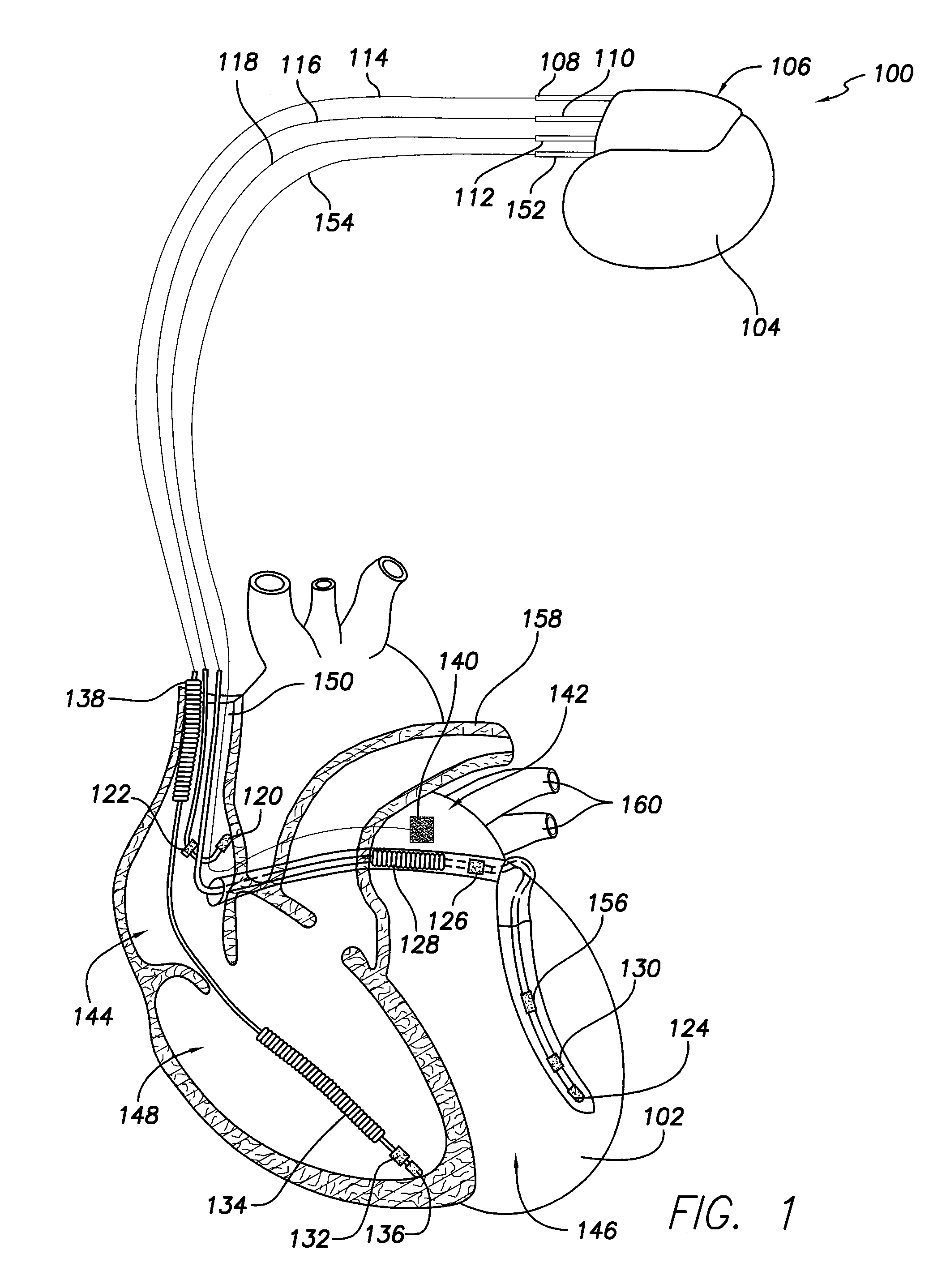 Systems and Methods for Adjusting a Pacing Rate Based on Cardiac Pressure