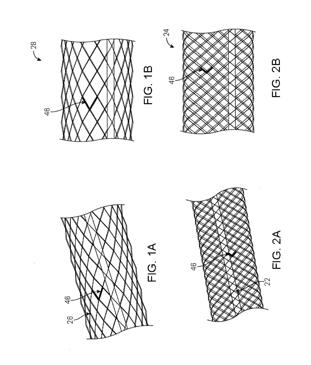 Vaso-occlusive devices and methods of use