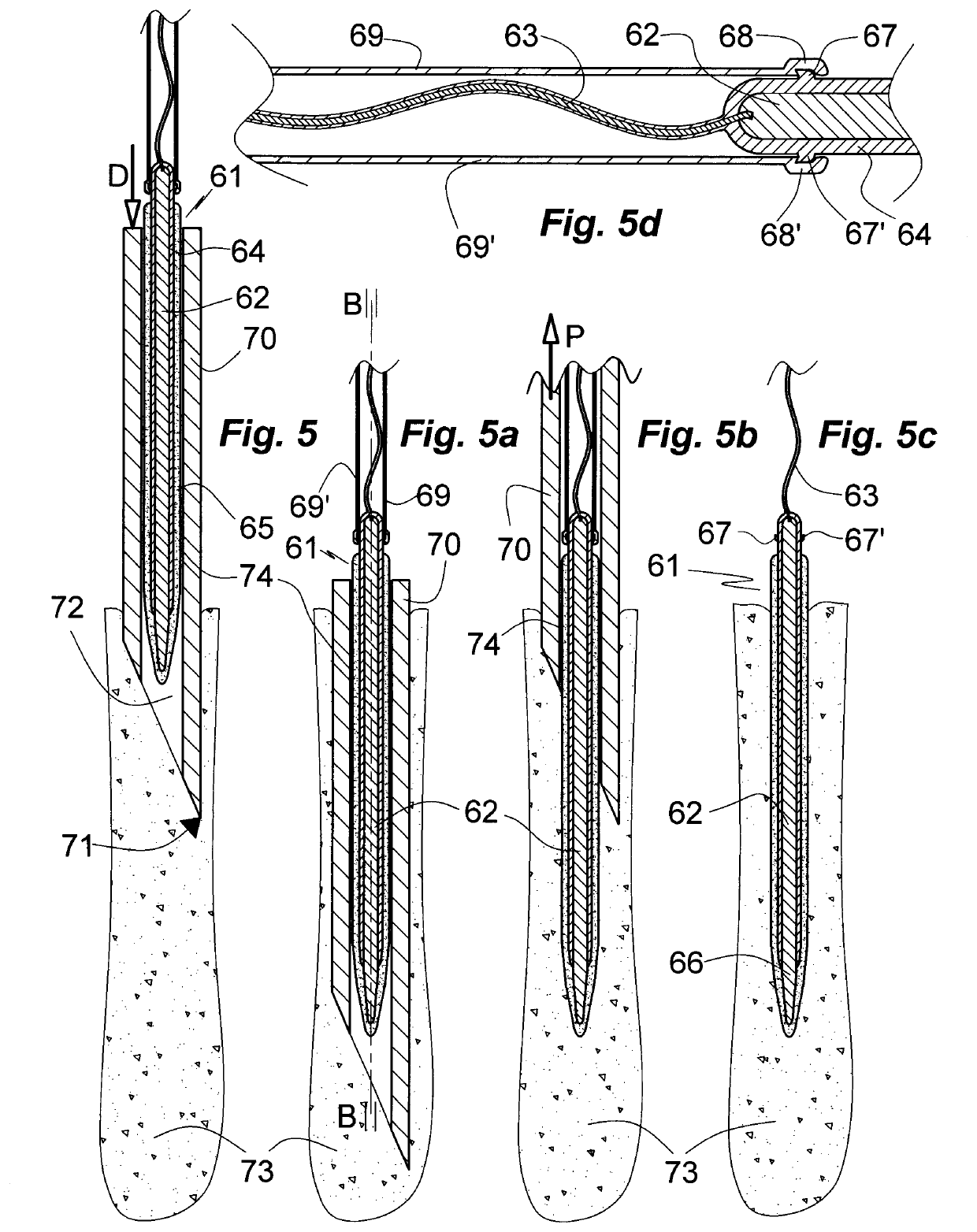 Device for insertion into nervous tissue