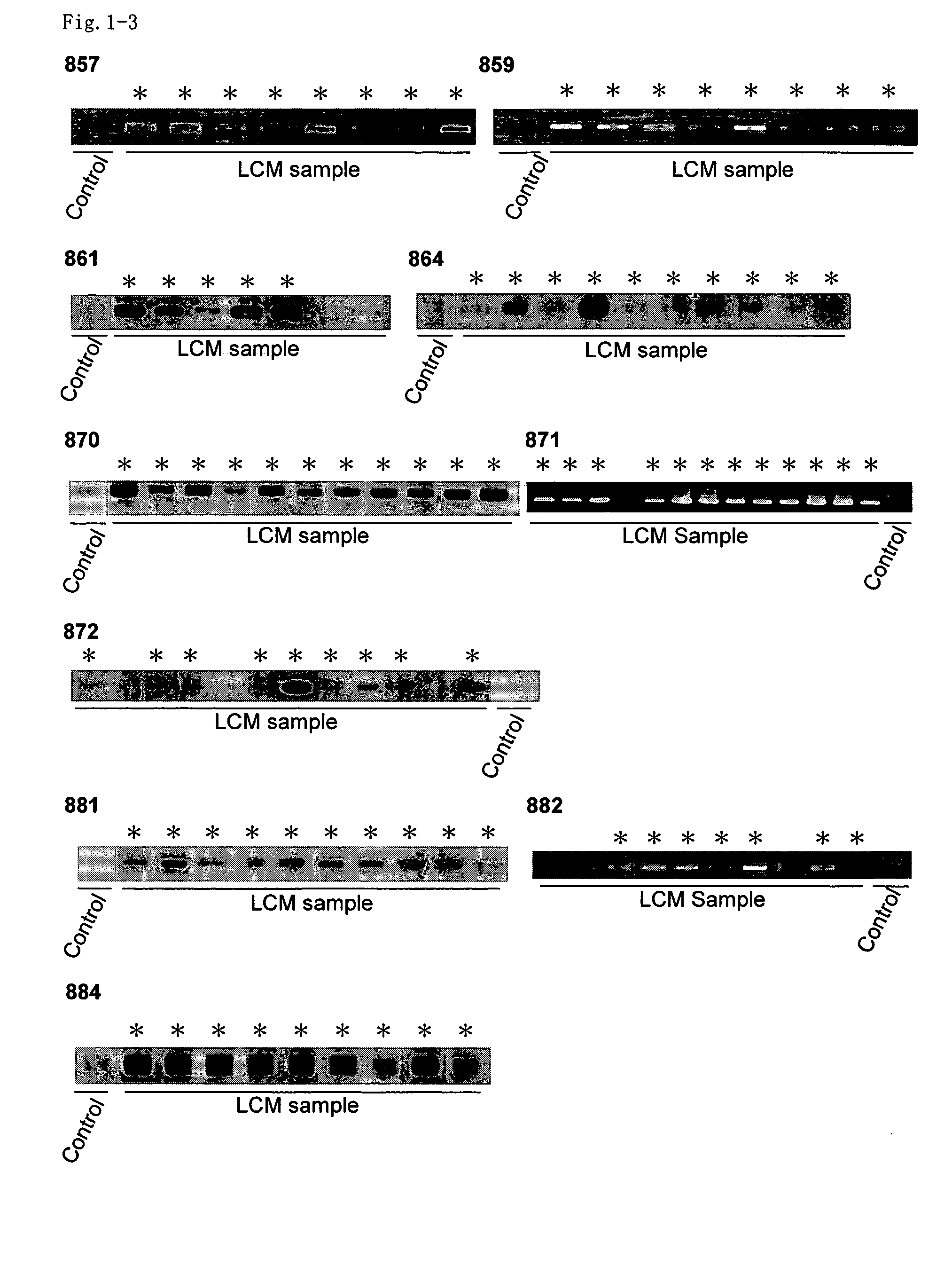 Method for diagnosing non-small cell lung cancers