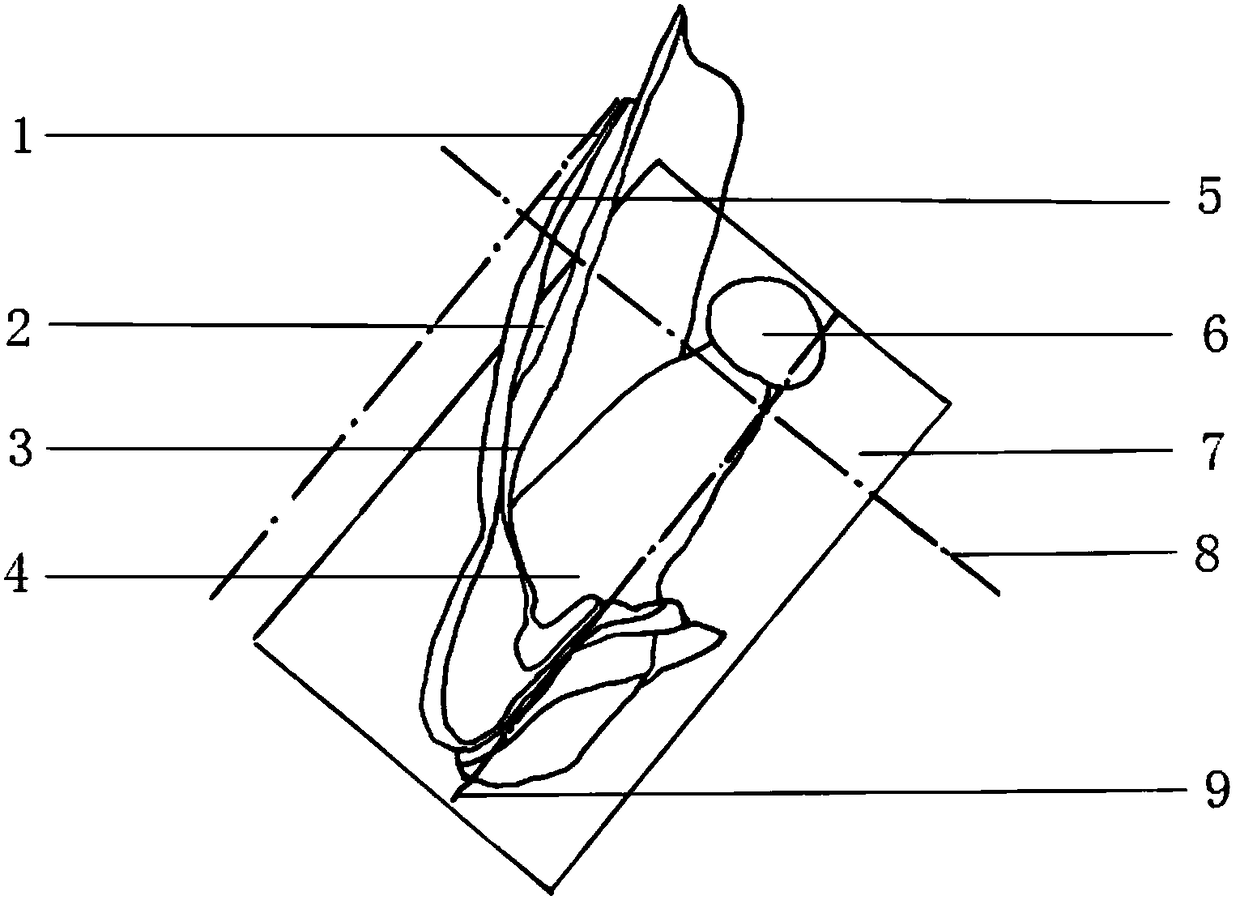 Digital designing and manufacturing method for apical surgery guide plate