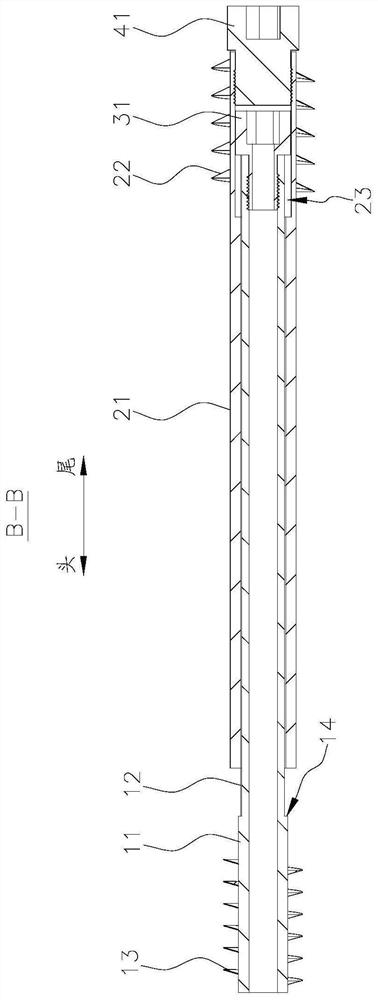 Femoral neck bidirectional pressurizing distance-limiting sliding screw and screwdriver