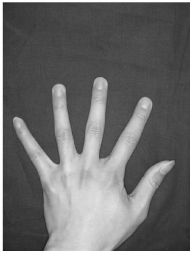 A method for extracting the midline of a finger