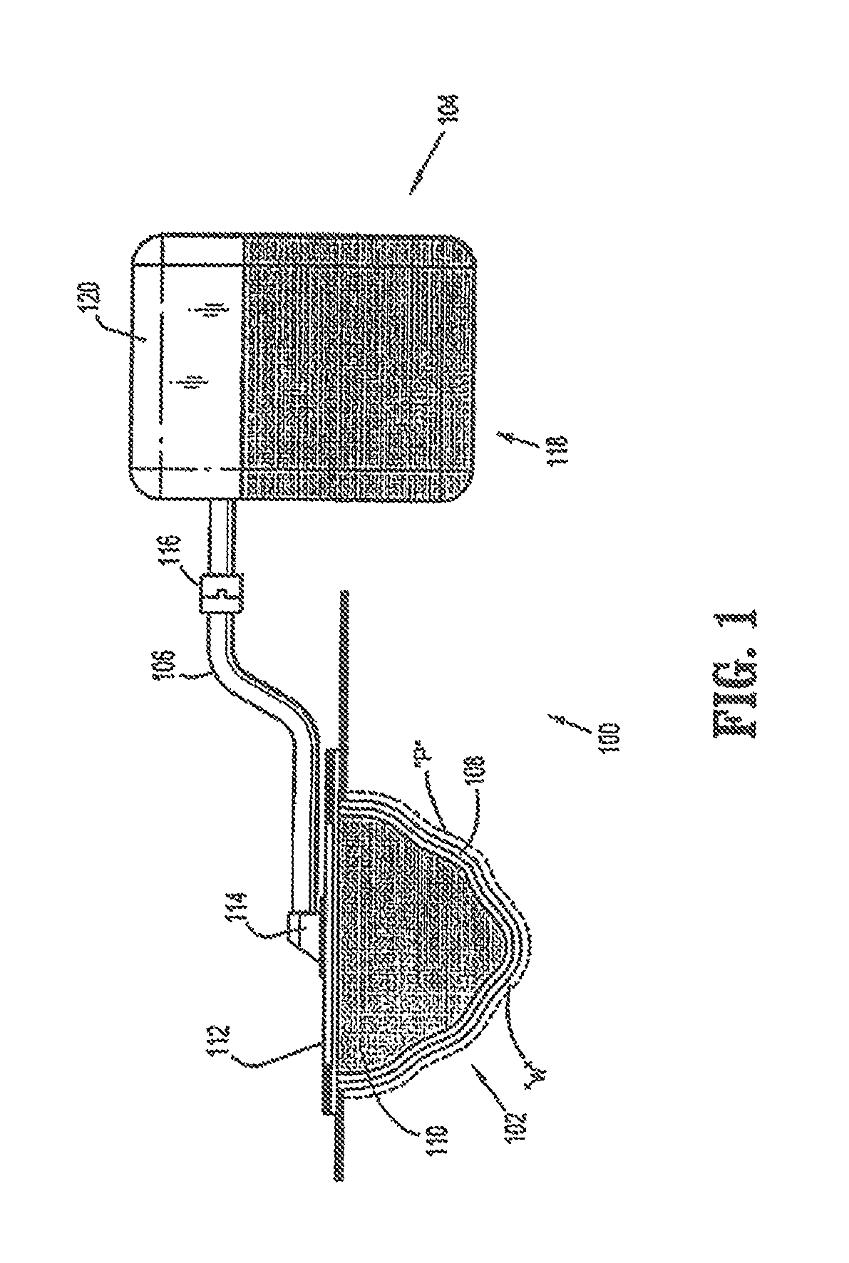 Wound therapy system with proportional valve mechanism