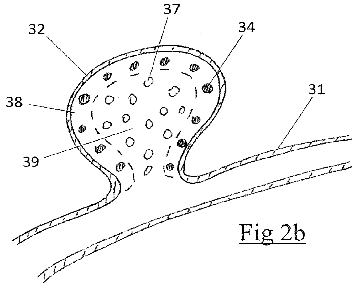 DEVICE AND METHOD FOR ENDOVASCULAR TREATMENT OF ANEURYSMS USING EMBOLIC ePTFE