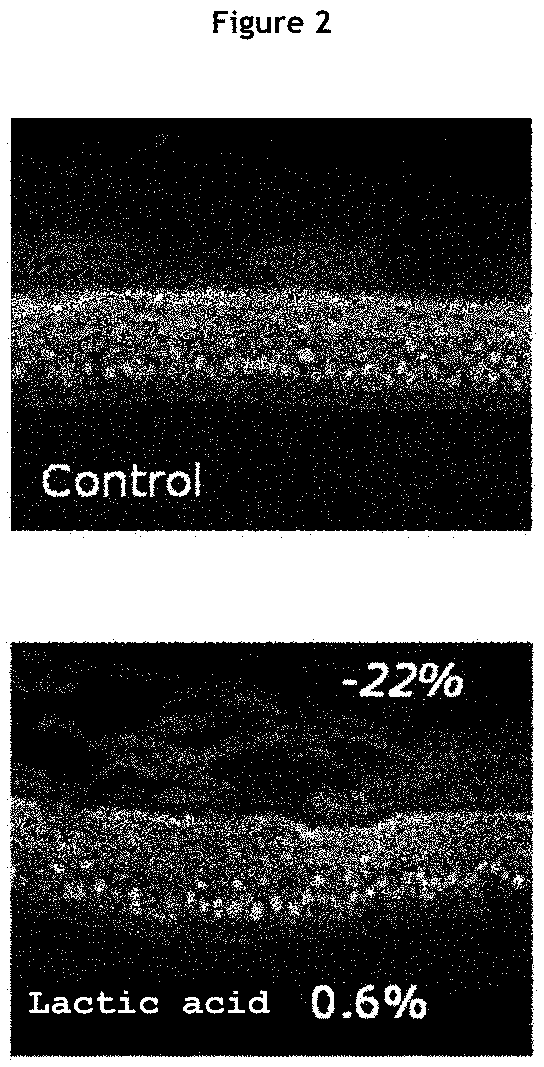 Models of Reconstructed Sensitive Skin