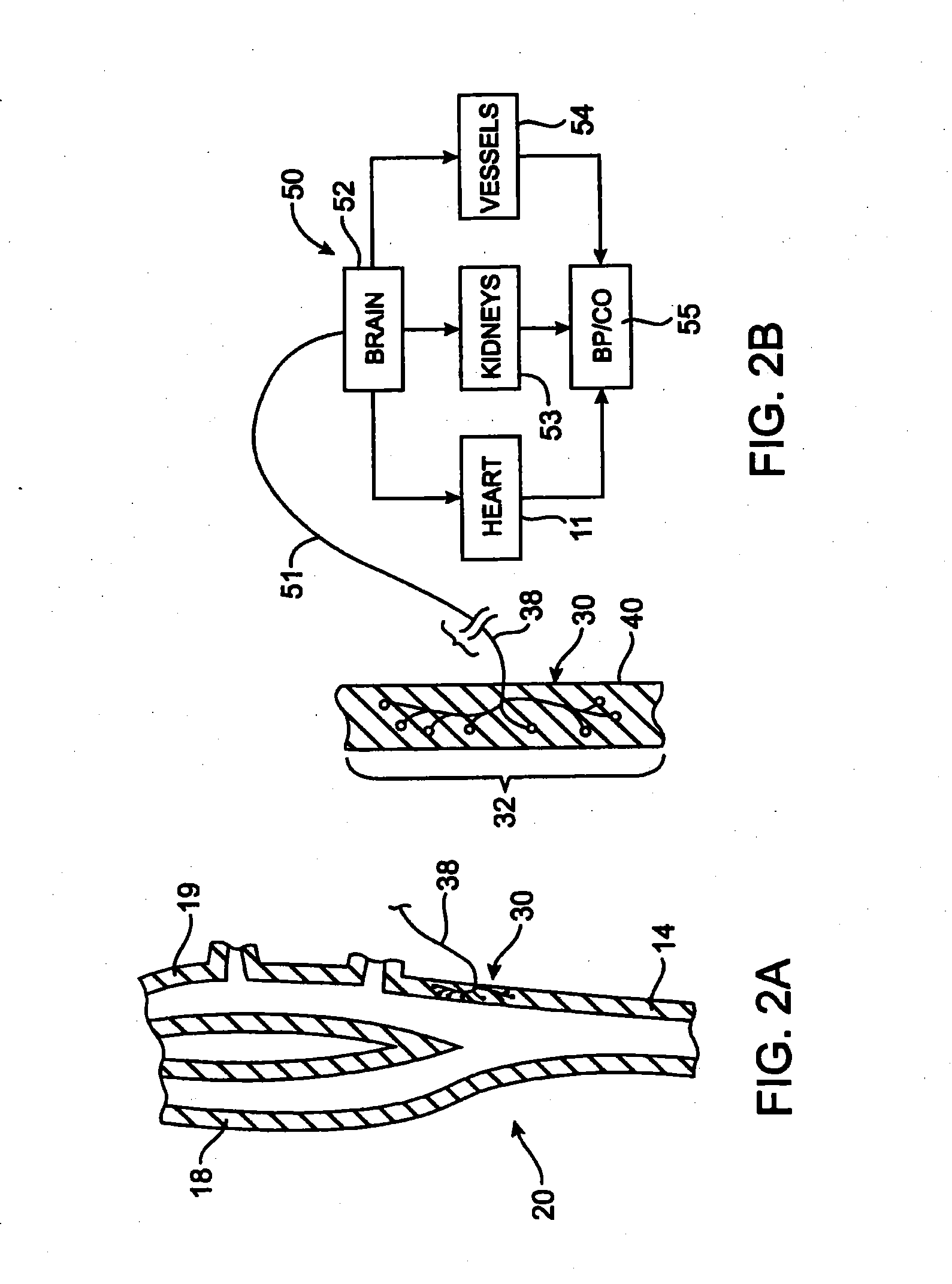 Devices and methods for cardiovascular reflex control via coupled electrodes