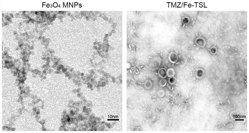 Temozolomide magnetic temperature-sensitive liposome and preparation method thereof