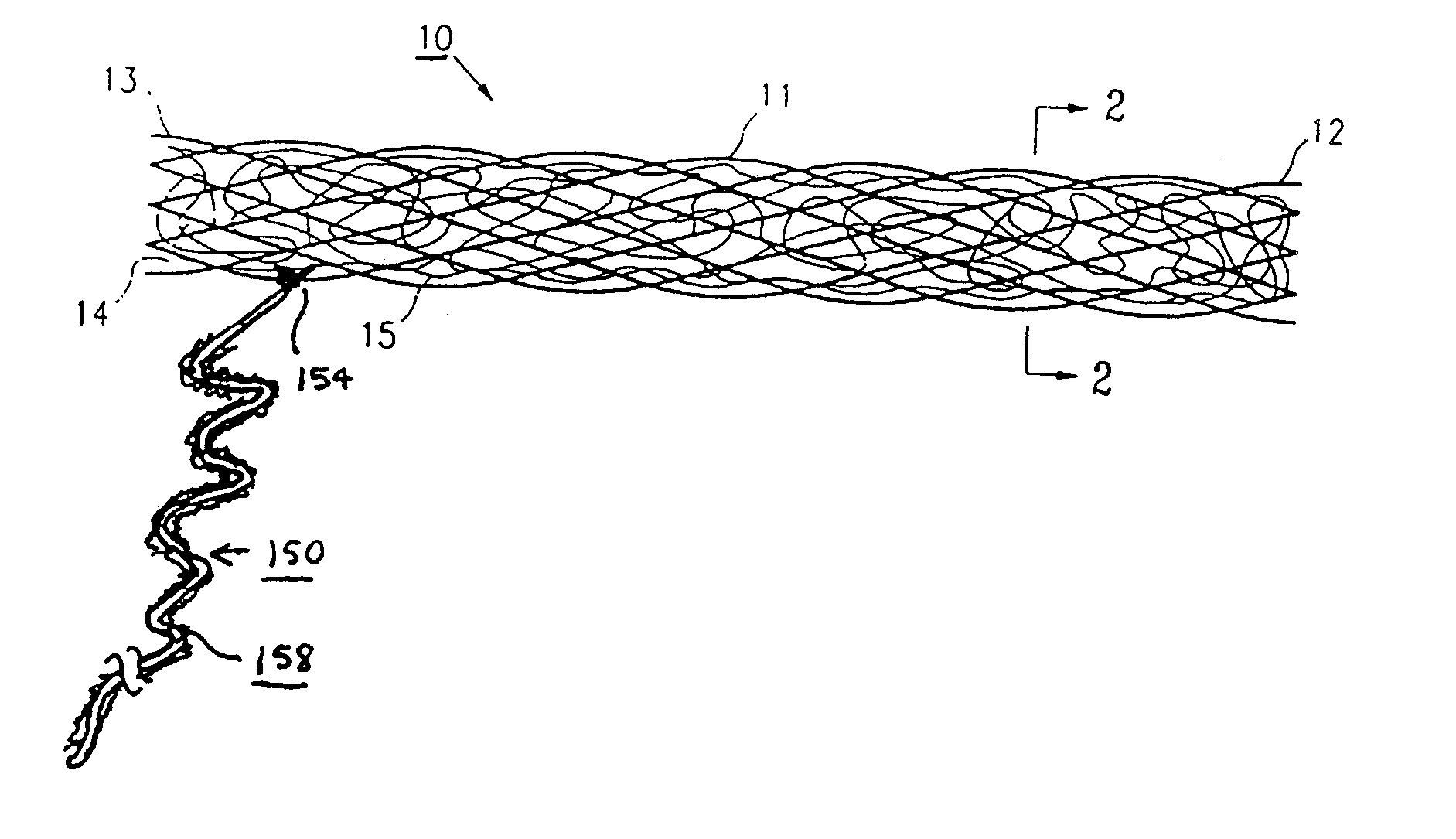 Methods and Apparatus for Occluding Reproductive Tracts to Effect Contraception