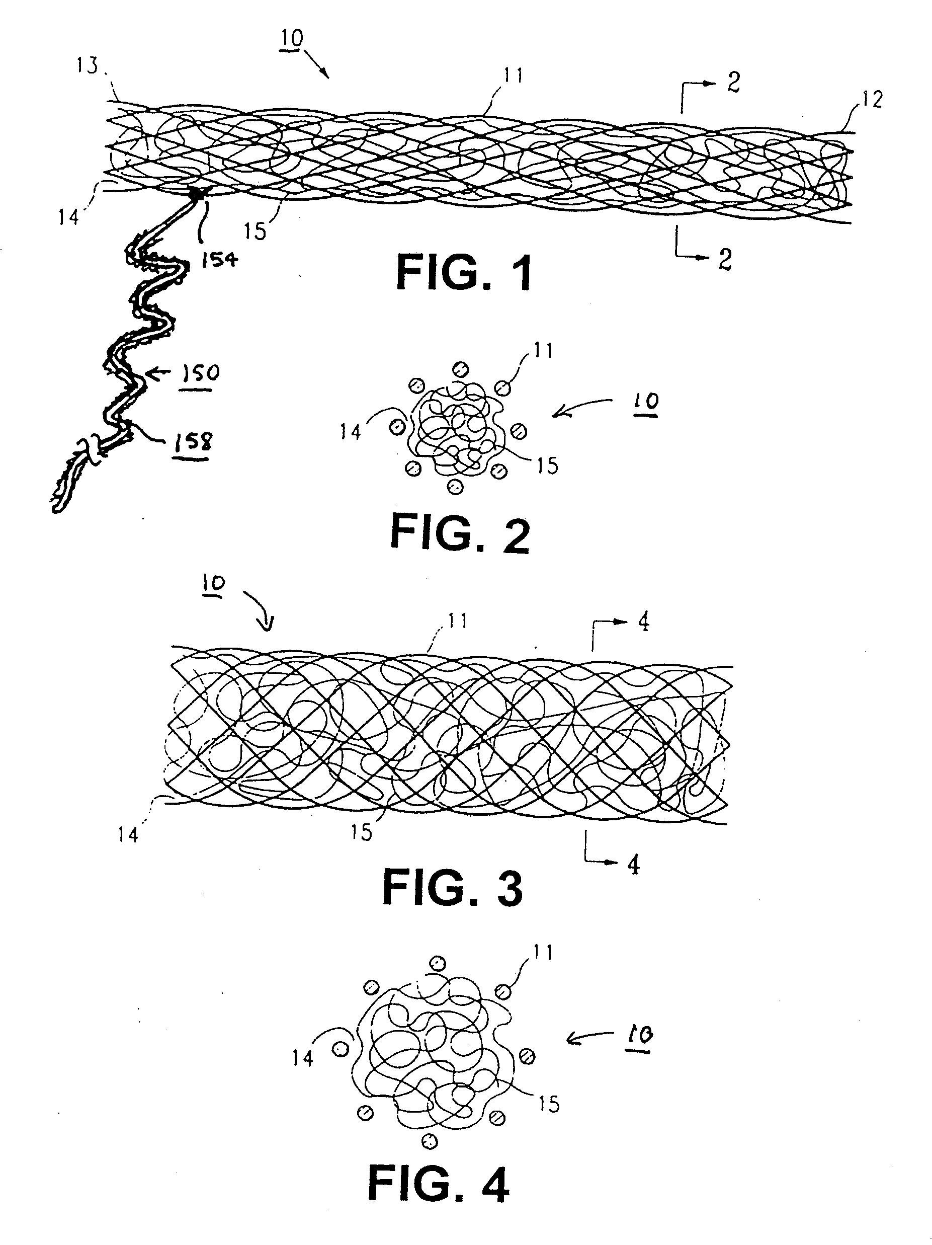 Methods and Apparatus for Occluding Reproductive Tracts to Effect Contraception