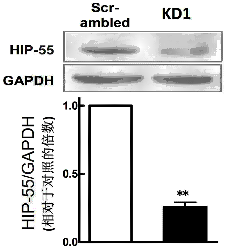 Novel application of HIP-55 (hematopoietic progenitor kinase 1 [HPK1]-interacting protein of 55kDa)