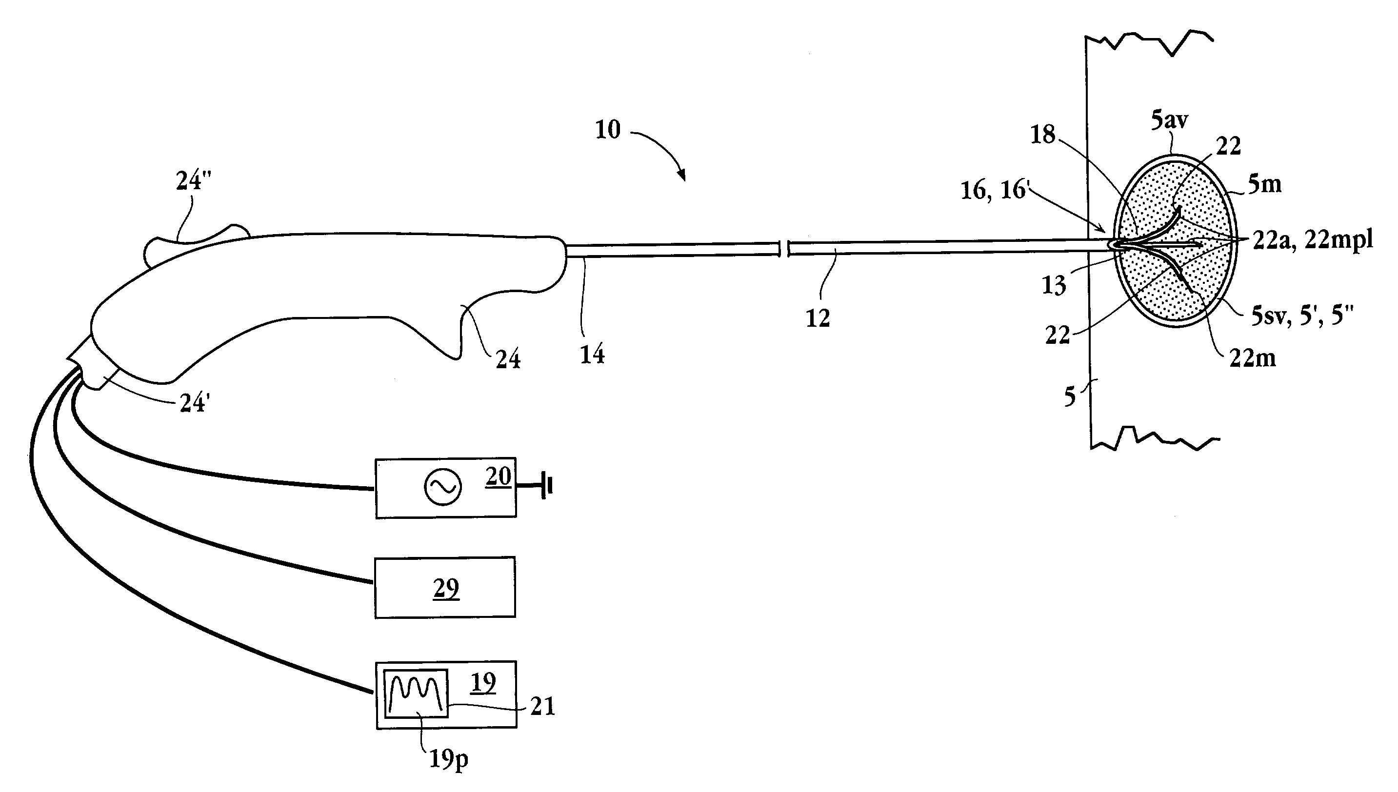 Apparatus for detecting and treating tumors using localized impedance measurement