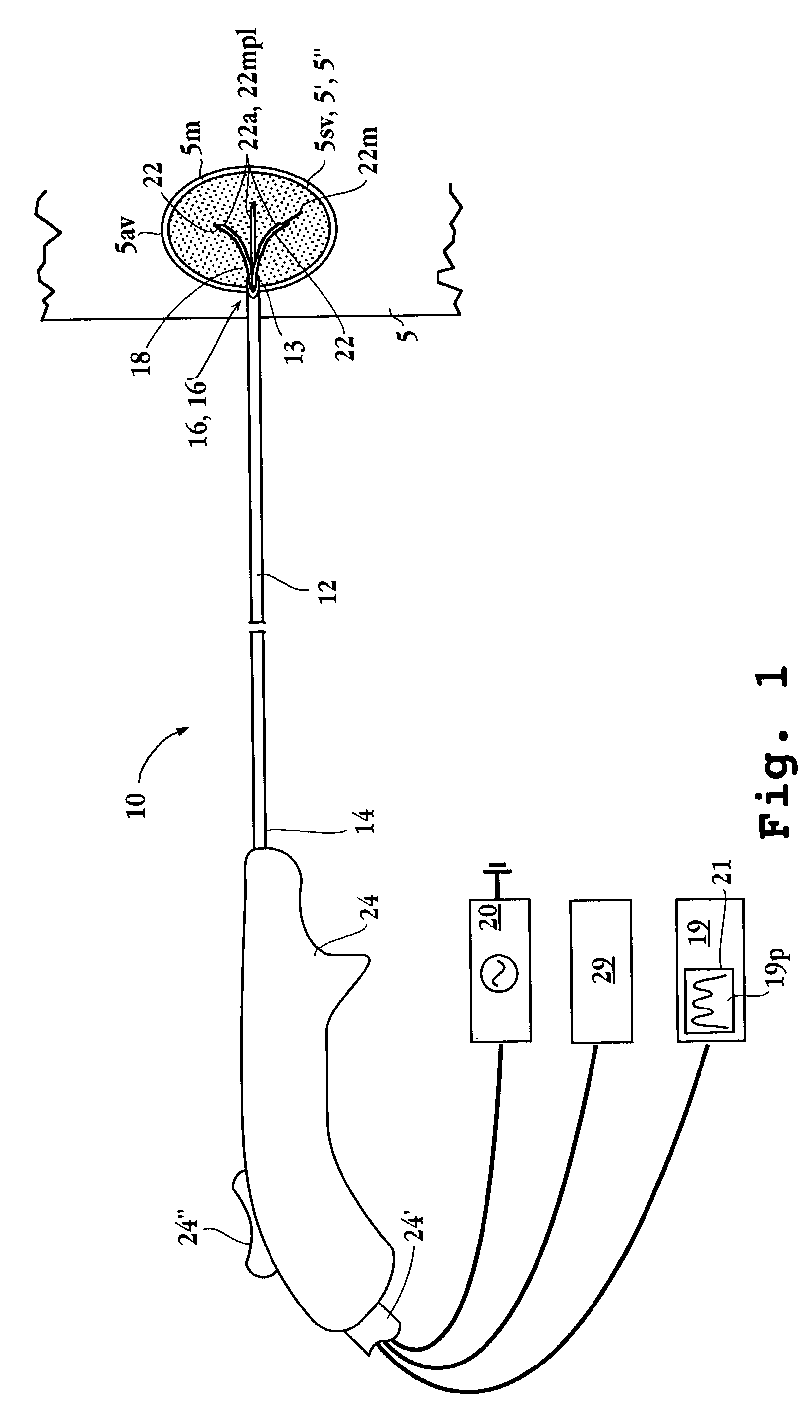 Apparatus for detecting and treating tumors using localized impedance measurement