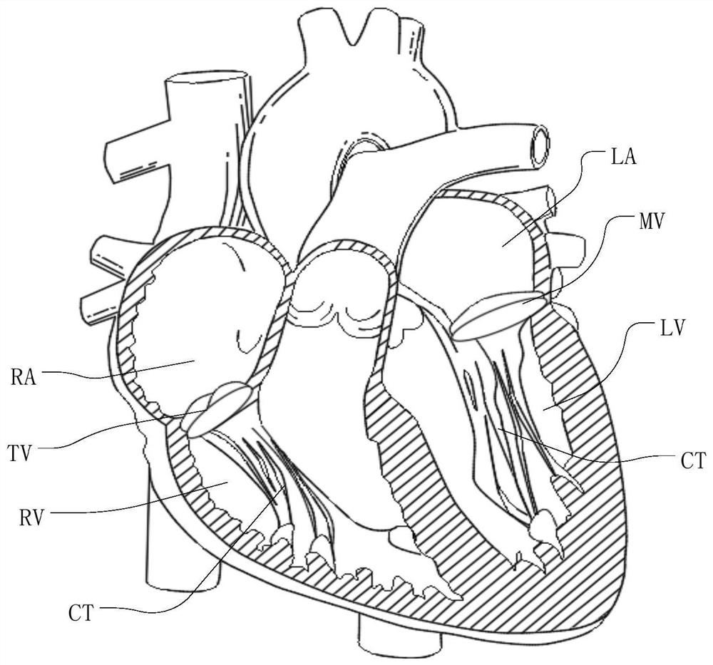 Guidable valve suturing device and valve suturing system