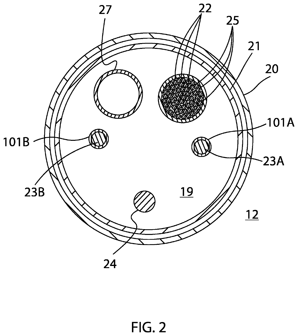 Catheter with staggered electrodes spine assembly