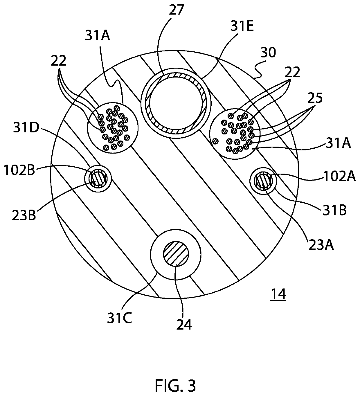 Catheter with staggered electrodes spine assembly