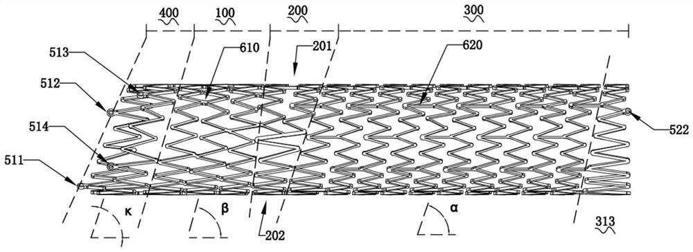 Self-expanding stent