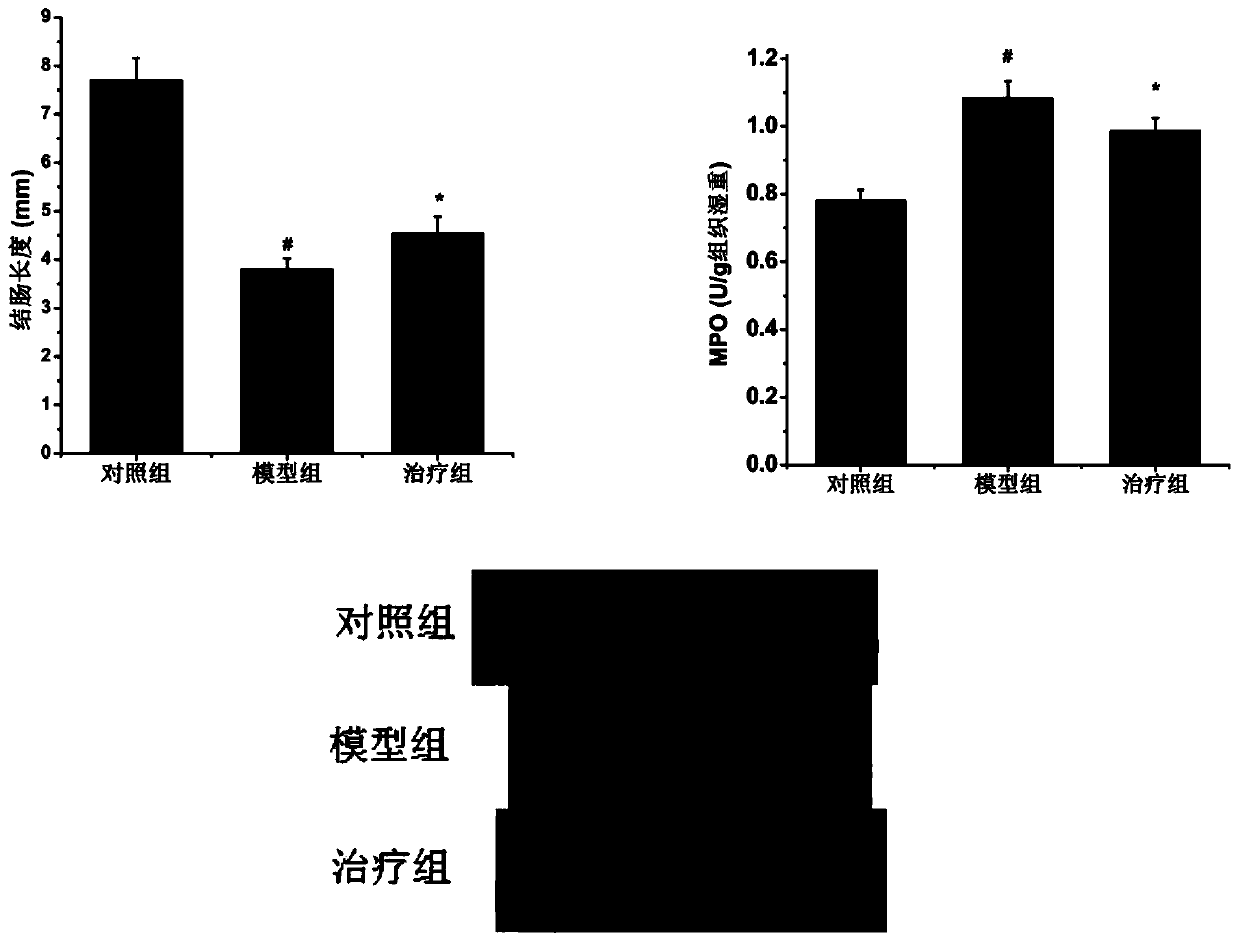Application of chitosan oligosaccharide to preparation of functional foods for intervening ulcerative colitis