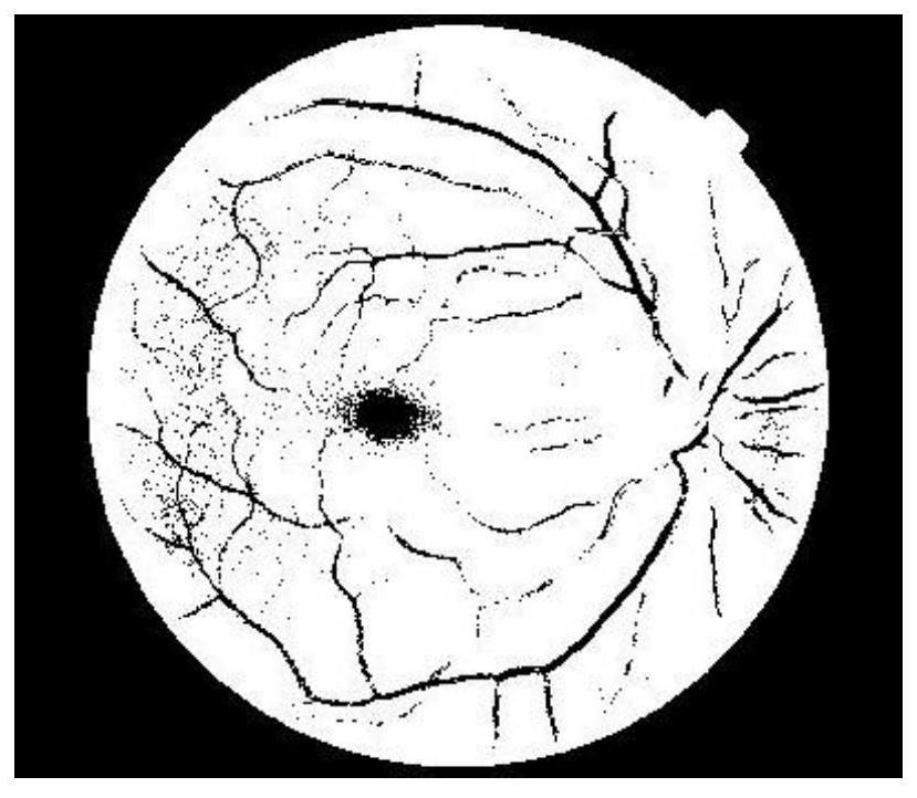 Fundus retinal blood vessel image processing system and method