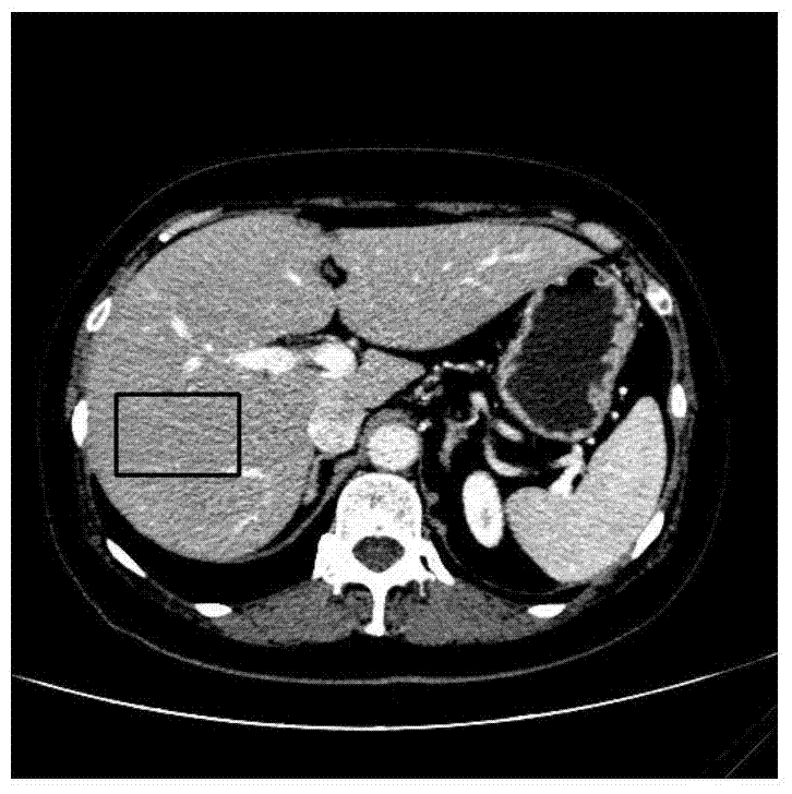 A Fast and Robust Automatic Segmentation Method for Liver in Abdominal CT Sequence Images