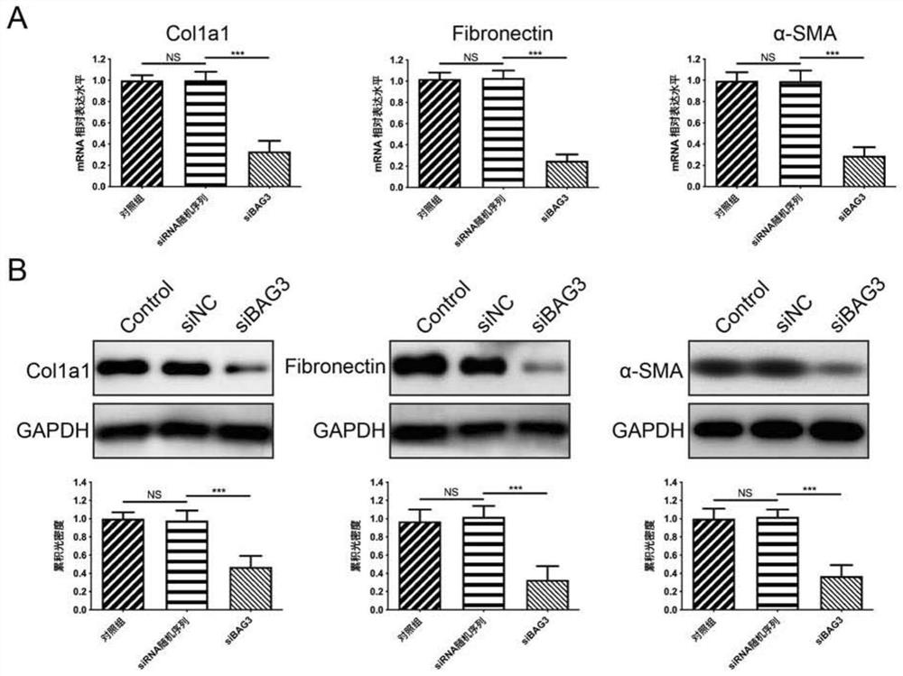 Application of BAG3 inhibitor in preparation of products for treating scars