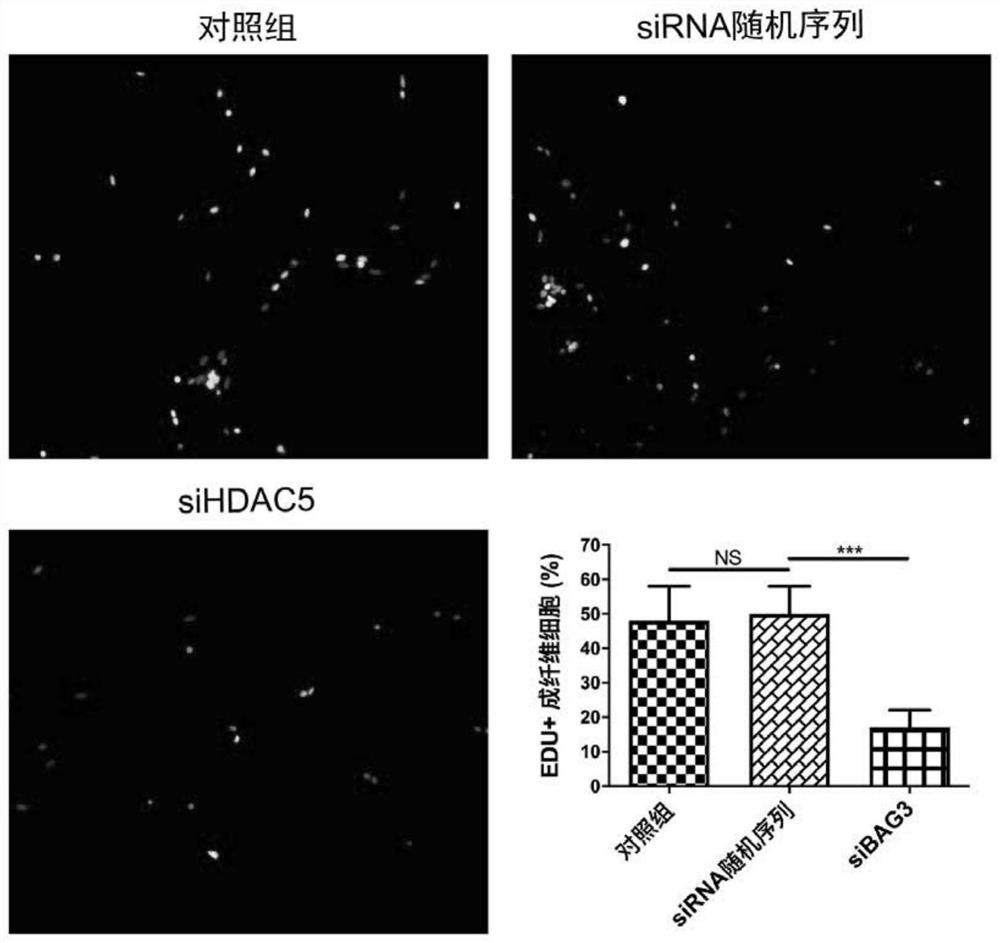 Application of BAG3 inhibitor in preparation of products for treating scars