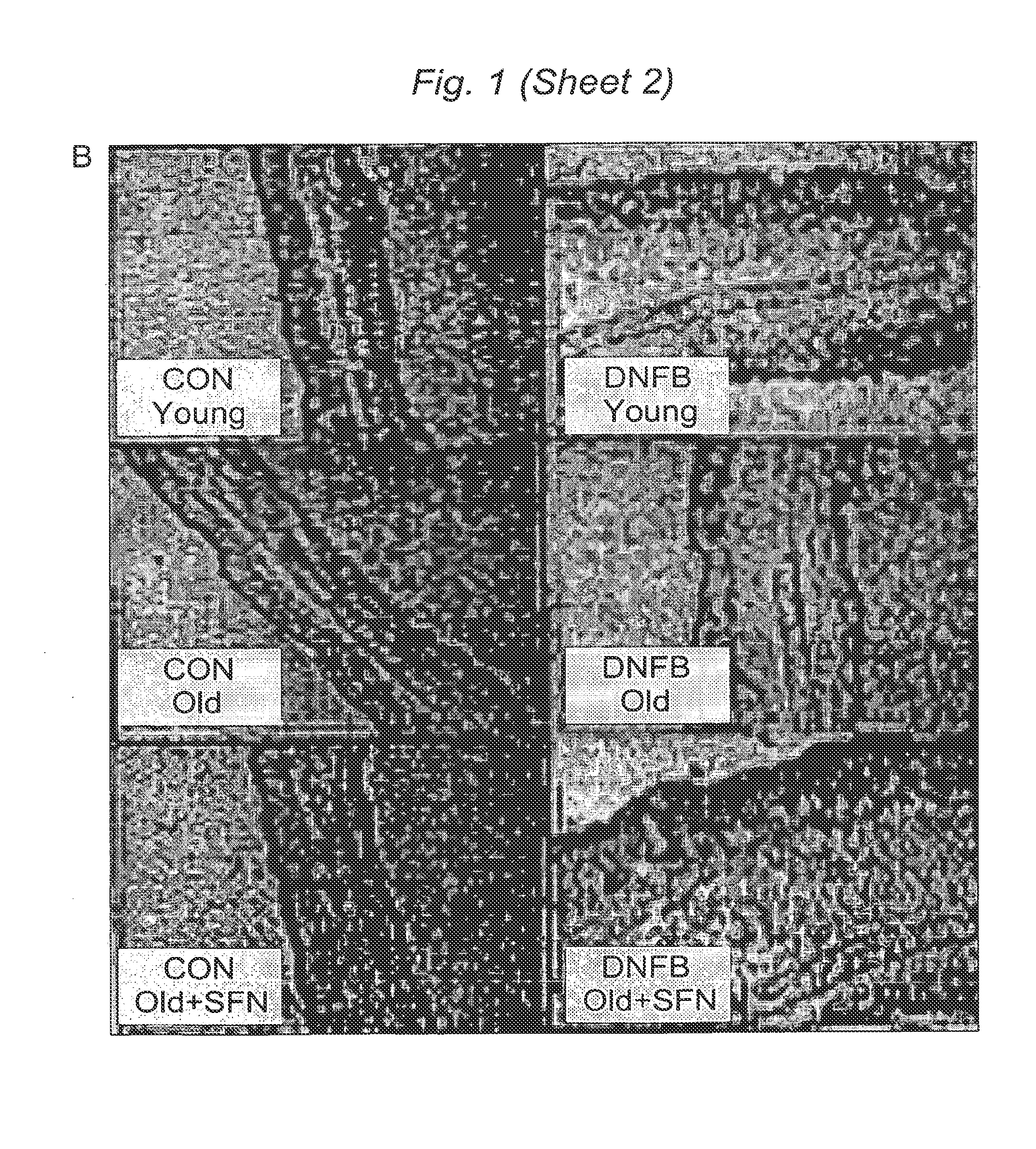 Methods and Compositions for Improving Immune Response by a Nutraceutical Antioxidant