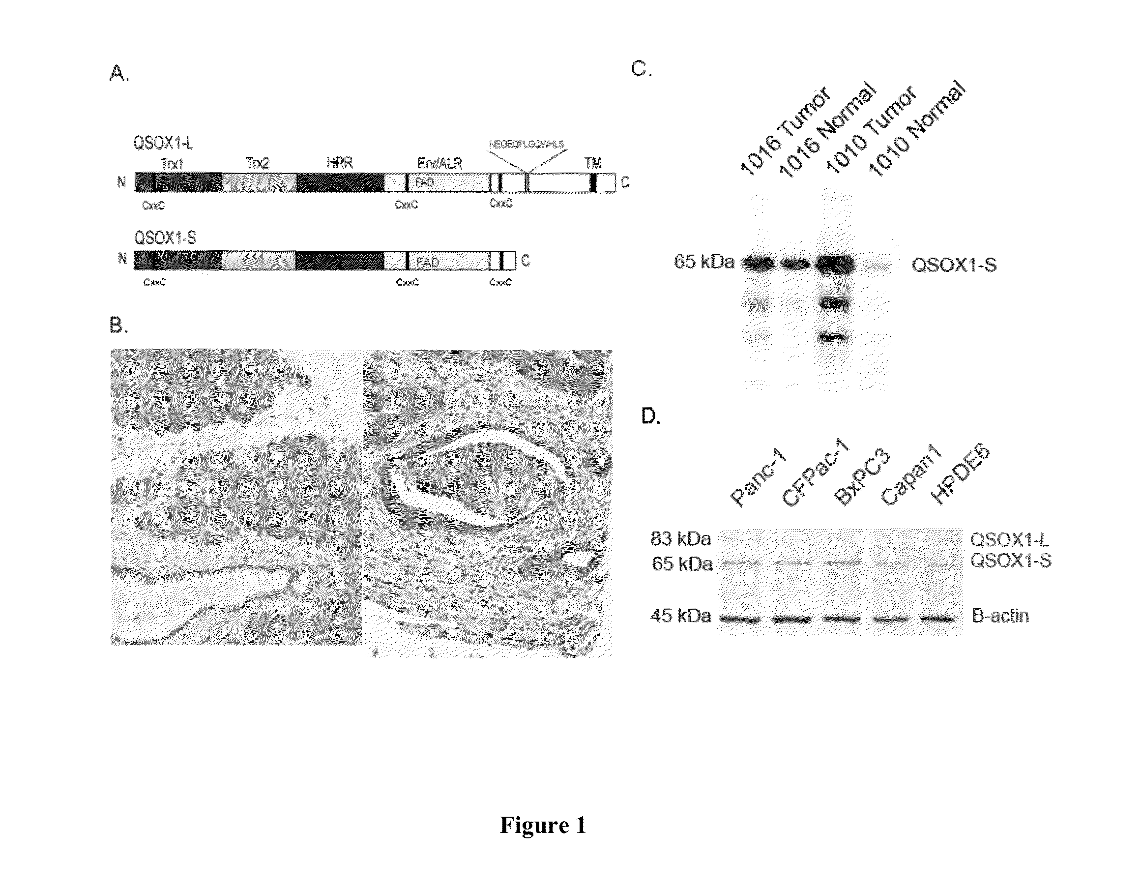 QSOX1 as an anti-neoplastic drug target