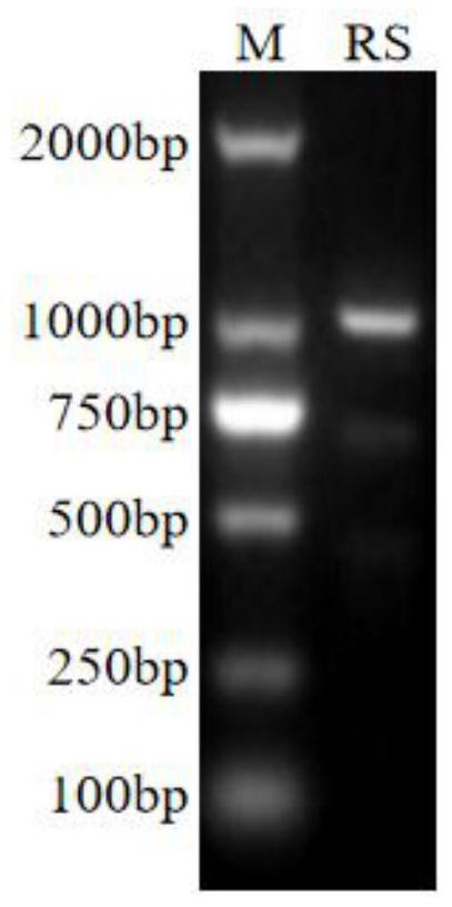 Resveratrol synthase gene RS derived from tetrastigma hemsleyanum diels et gilg and application thereof