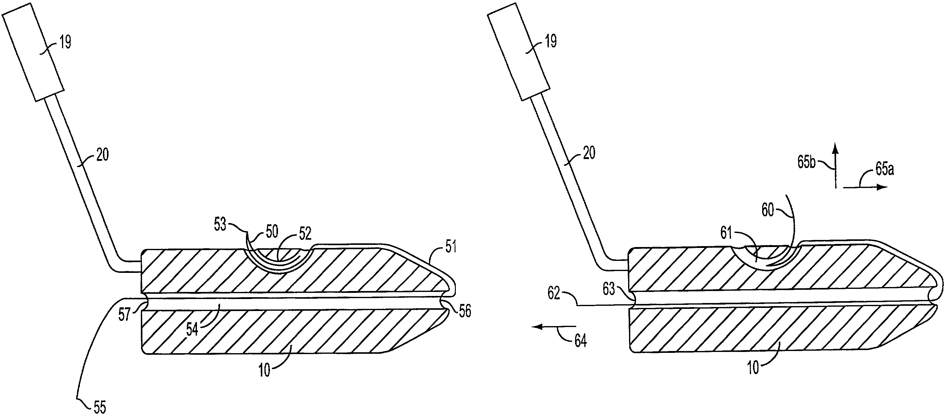 Devices and methods for positioning sutures