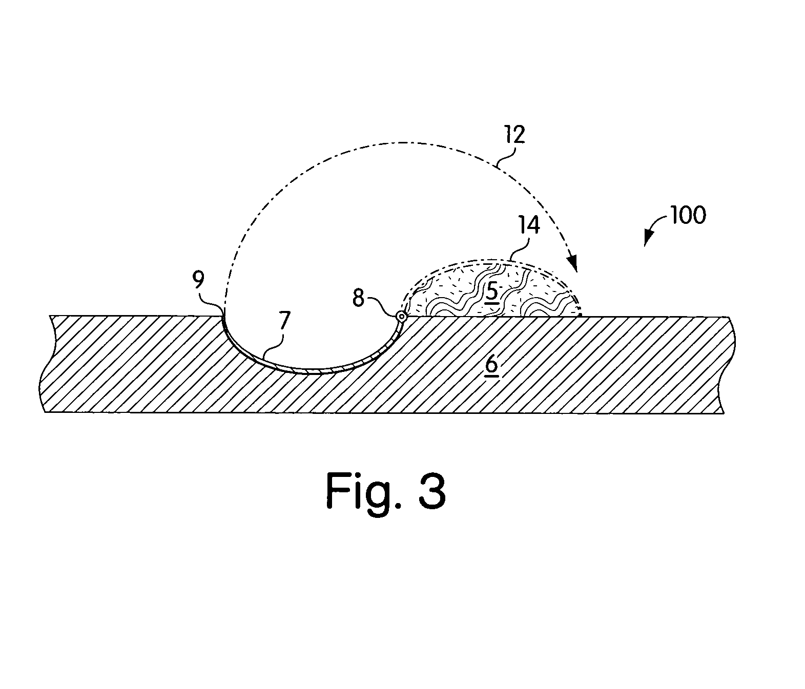 Tissue and fluid sampling device