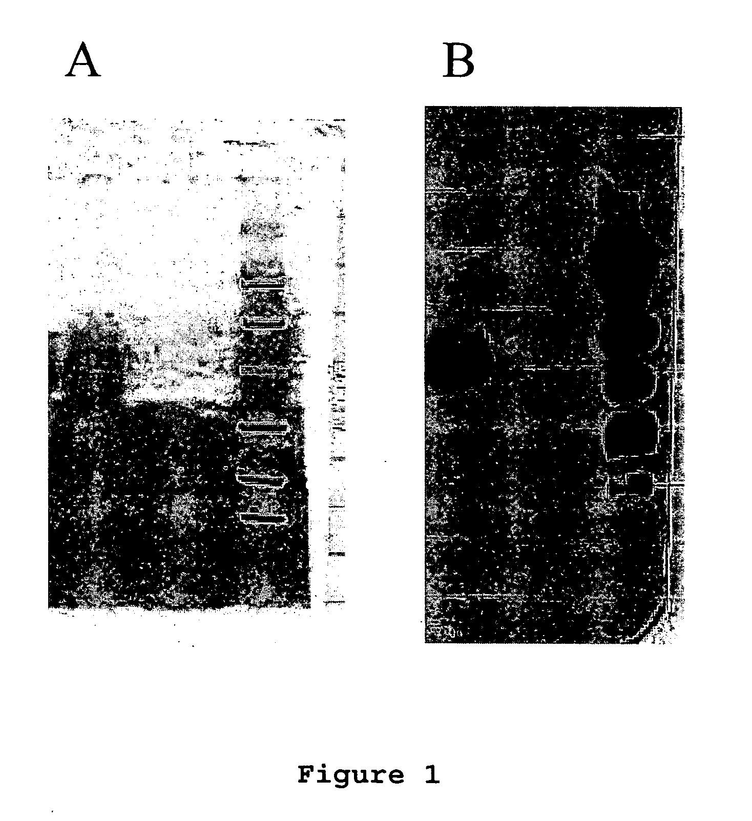 Method for assessing risk of and predisposition to development of a pathology related to the presence of anti-epcr autoantibodies