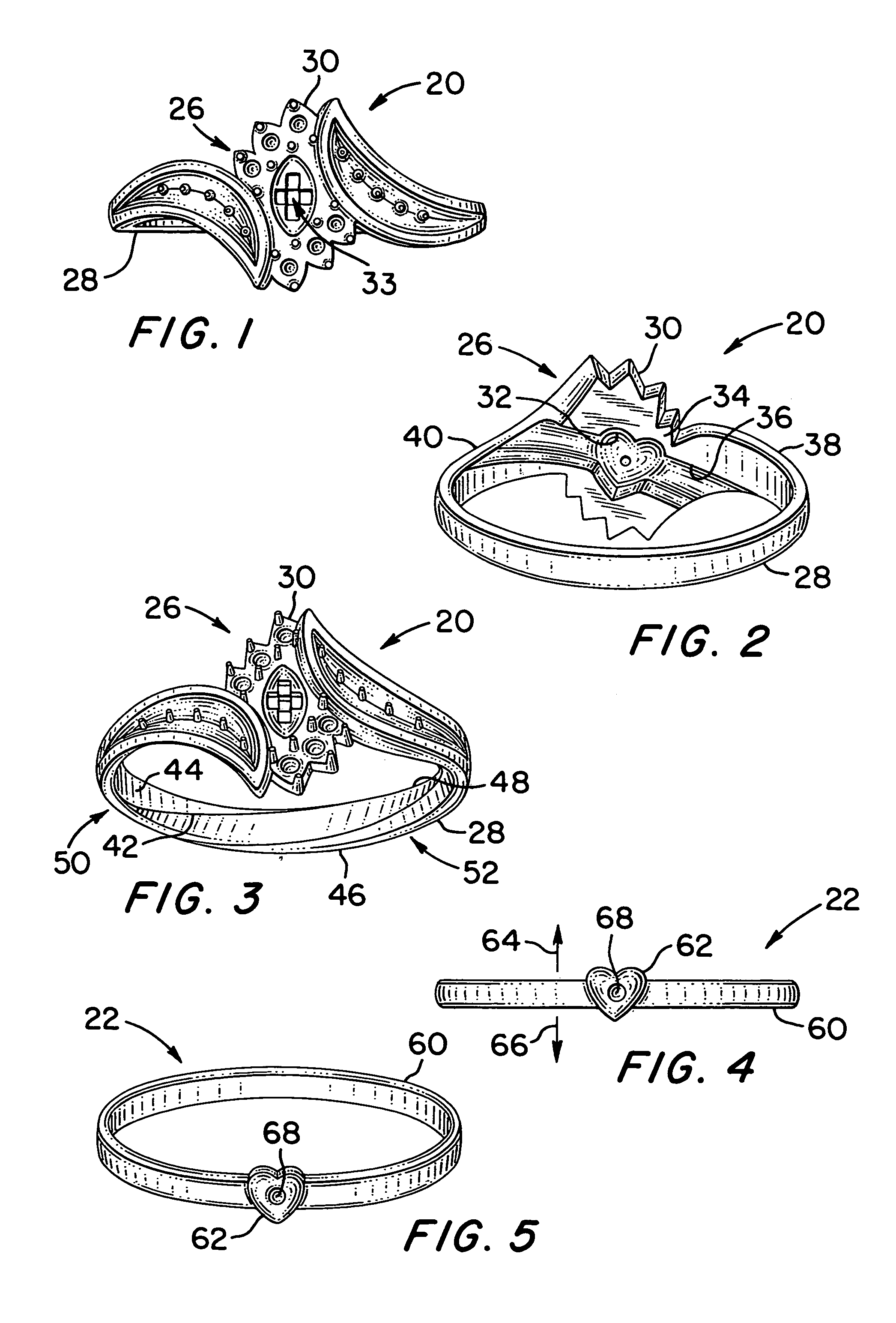 Engagement set with locking arrangement and rear crossover configuration