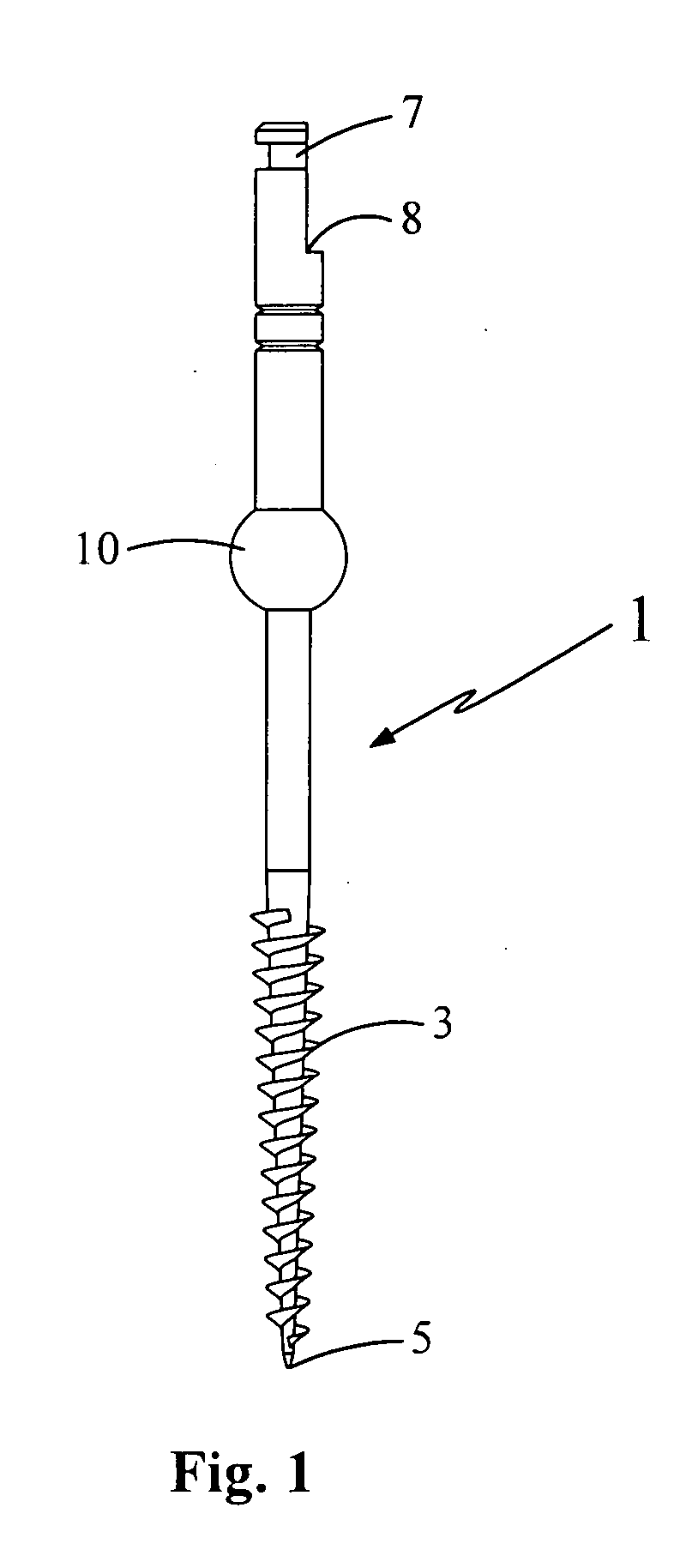 Dental system for root and root tip extraction