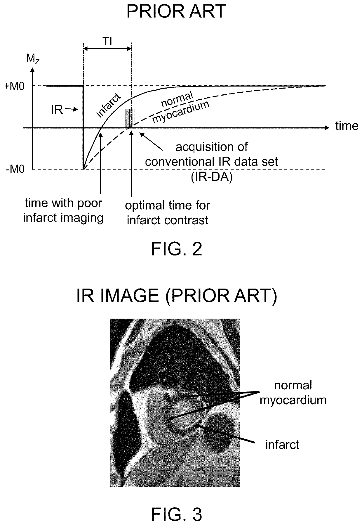 Systems and methods for phase-sensitive inversion recovery MR imaging with reduced sensitivity to cardiac motion