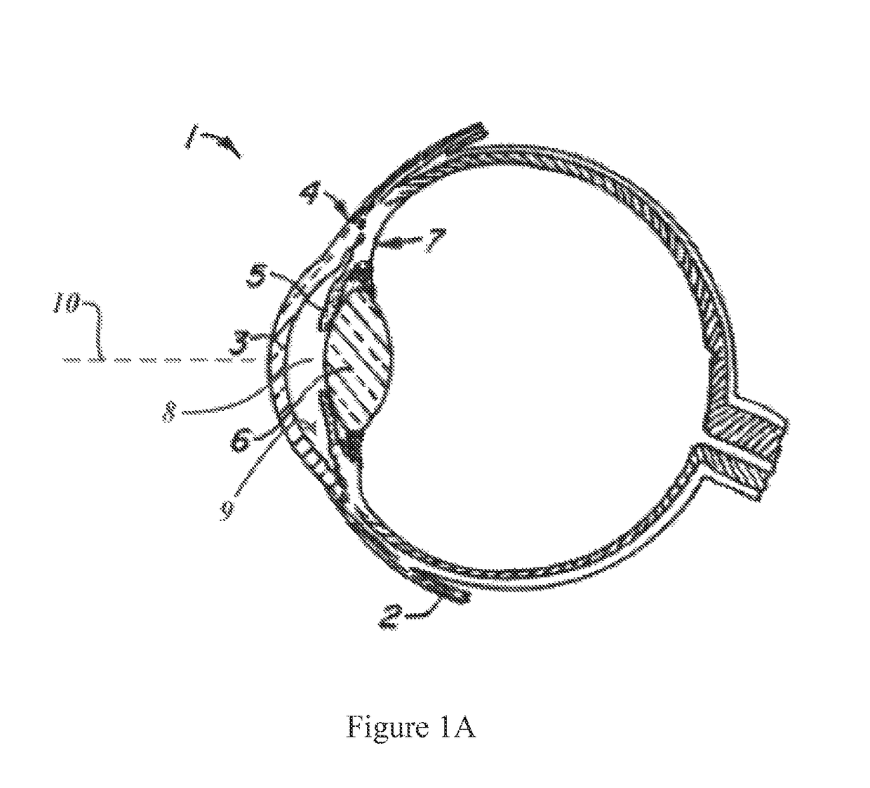 Convex contact probe for the delivery of laser energy