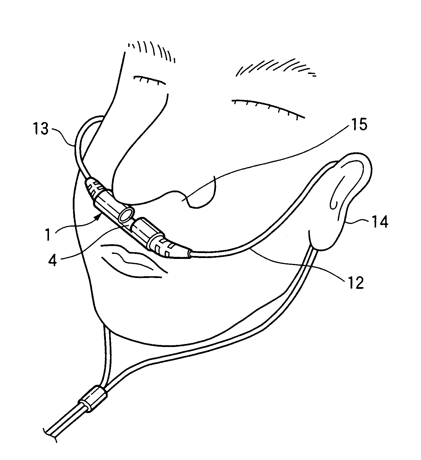 Sensor for measuring carbon dioxide in respiratory gas