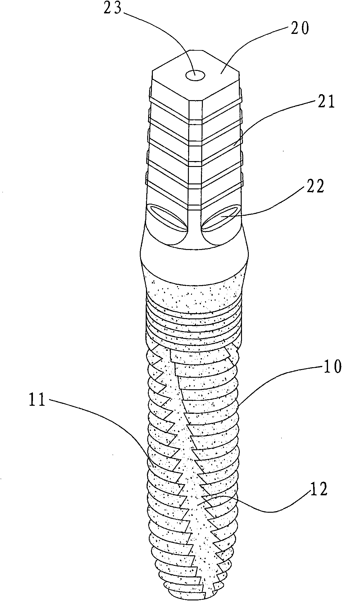 Production method of dental artificial implant