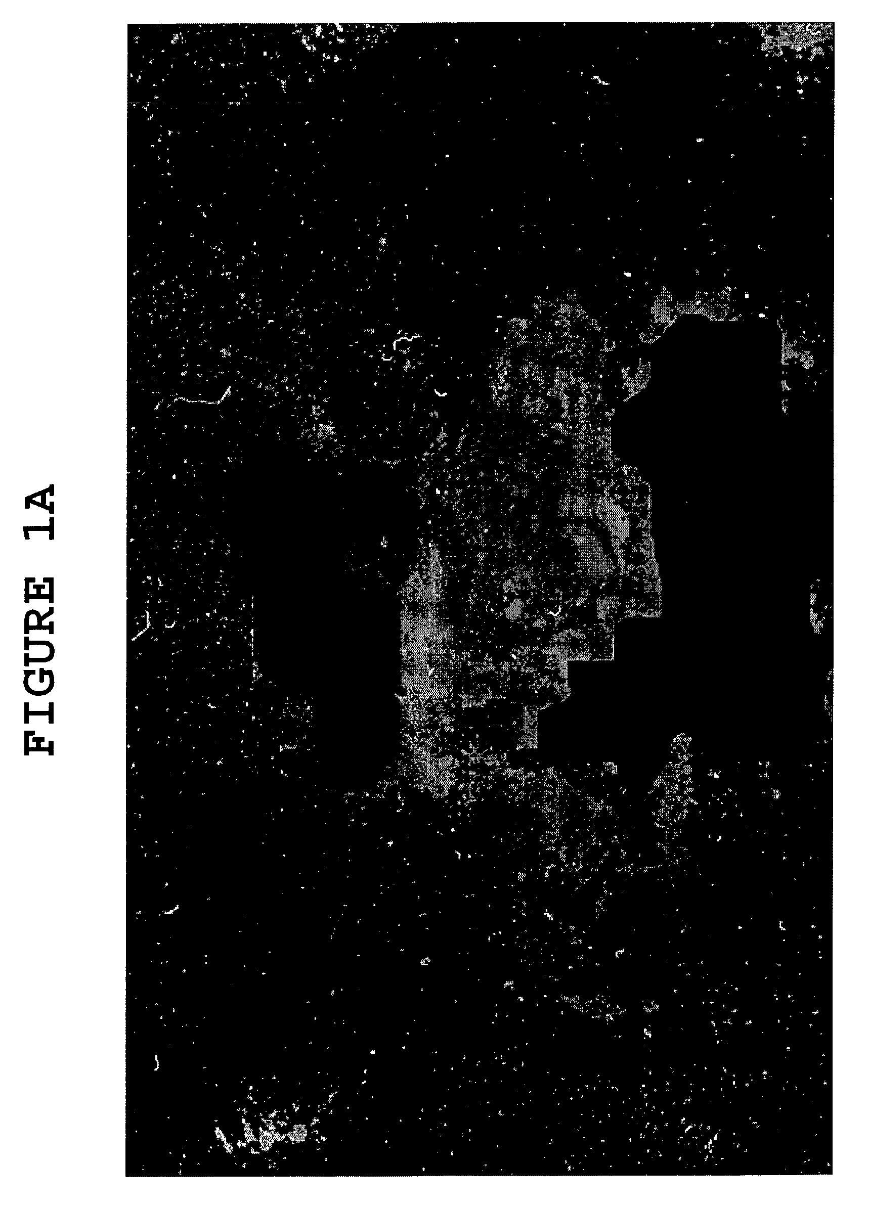 Methods and compositions for delivering enzymes and nucleic acid molecules to brain, bone and other tissues