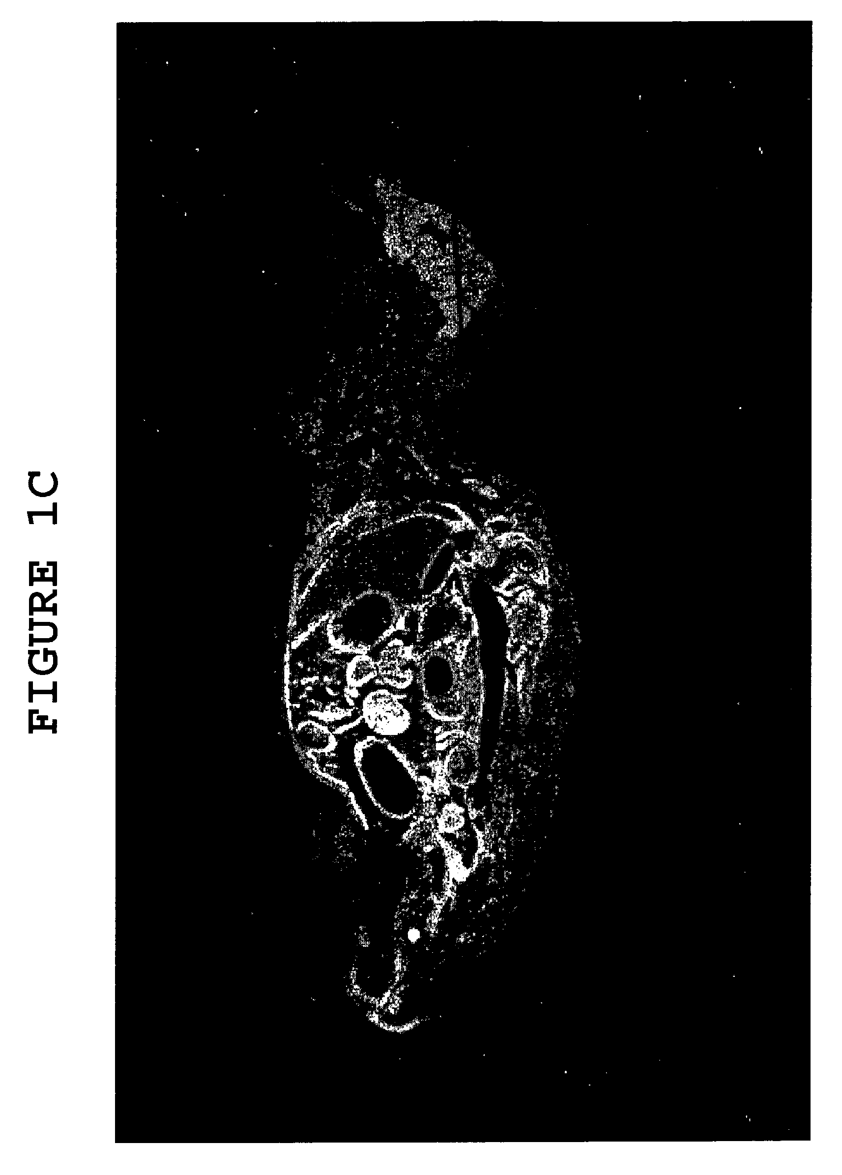 Methods and compositions for delivering enzymes and nucleic acid molecules to brain, bone and other tissues