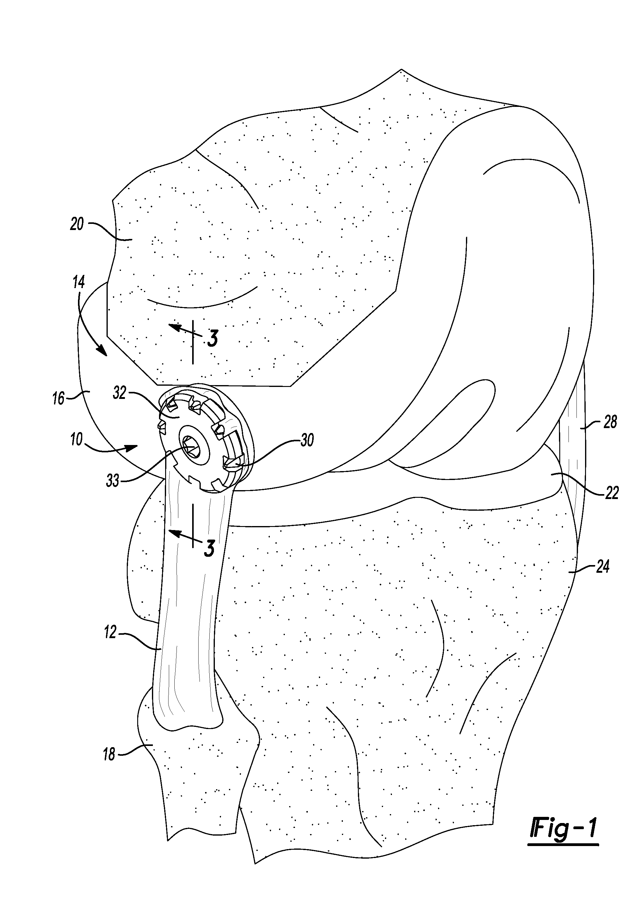 Method And Apparatus For Attaching Soft Tissue To Bone