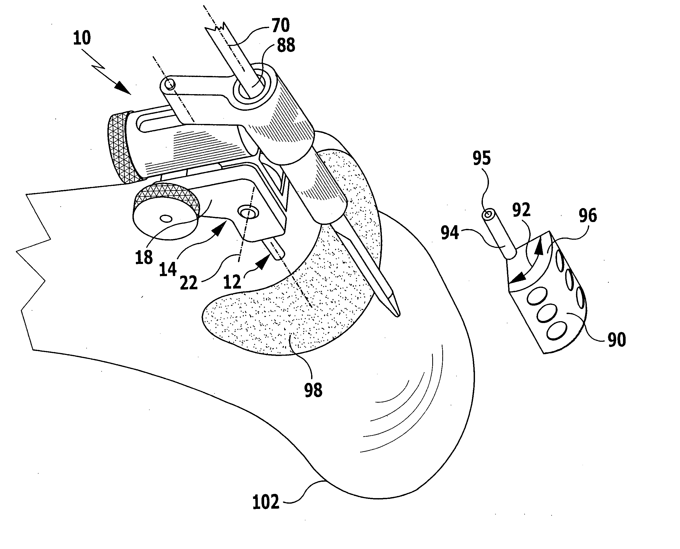 Surgical positioning and holding device