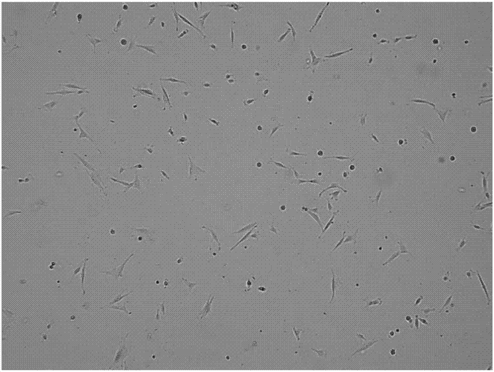 Culture method of oligodendrocyte precursor cells