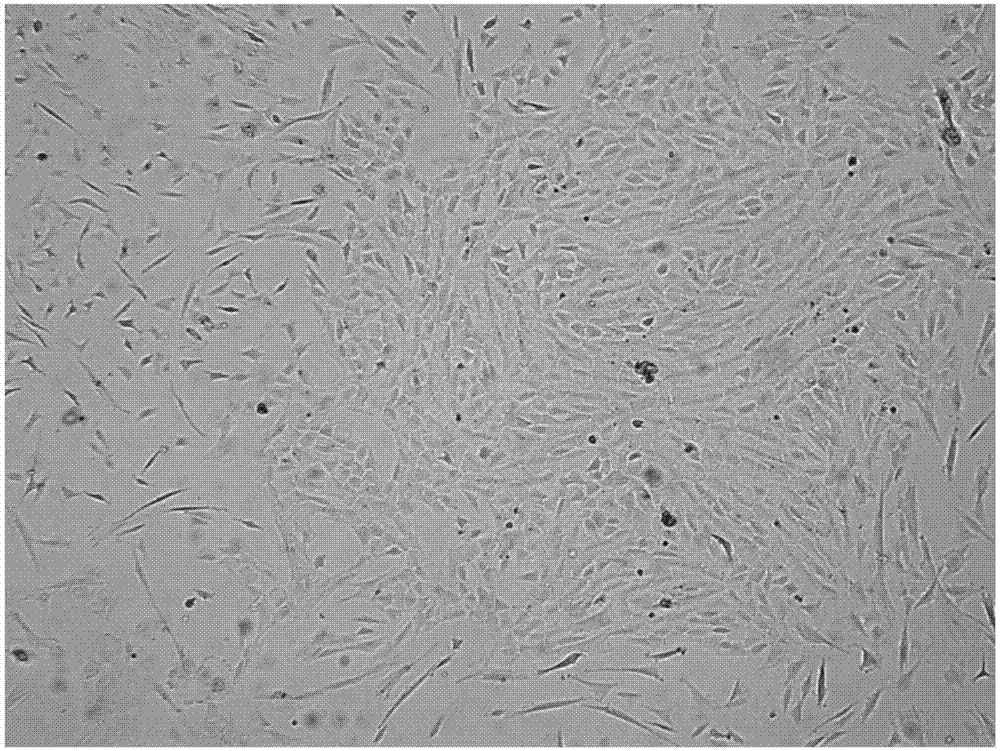 Culture method of oligodendrocyte precursor cells